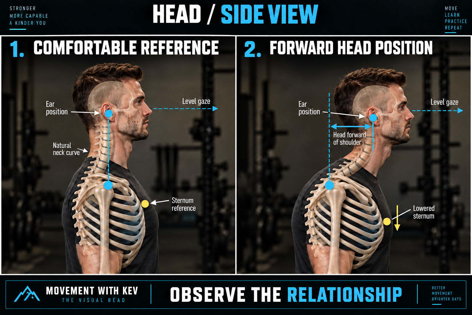 Two right-facing side views: a comfortable reference with the ear near the shoulder line, and a forward head example with the ear clearly ahead of a vertical shoulder reference. A horizontal arrow highlights the difference while the gaze remains level. Gold markers compare sternum position, with a downward arrow identifying the lowered sternum in the forward head example.