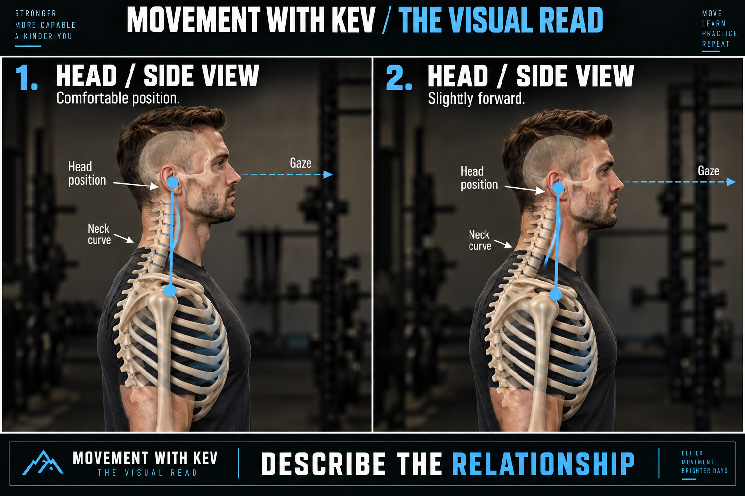HEAD — SIDE observation diagram: Head position / neck curve / gaze.